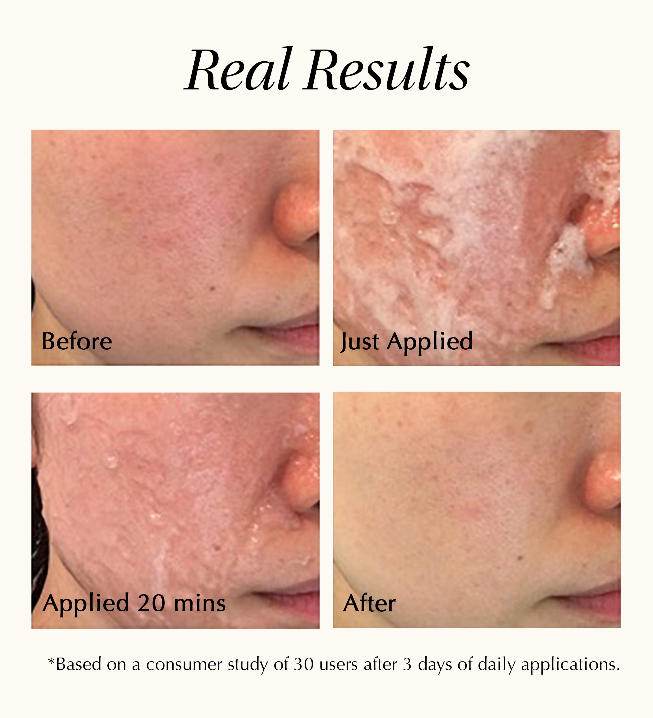Spaoxy Mask (3 Masks)