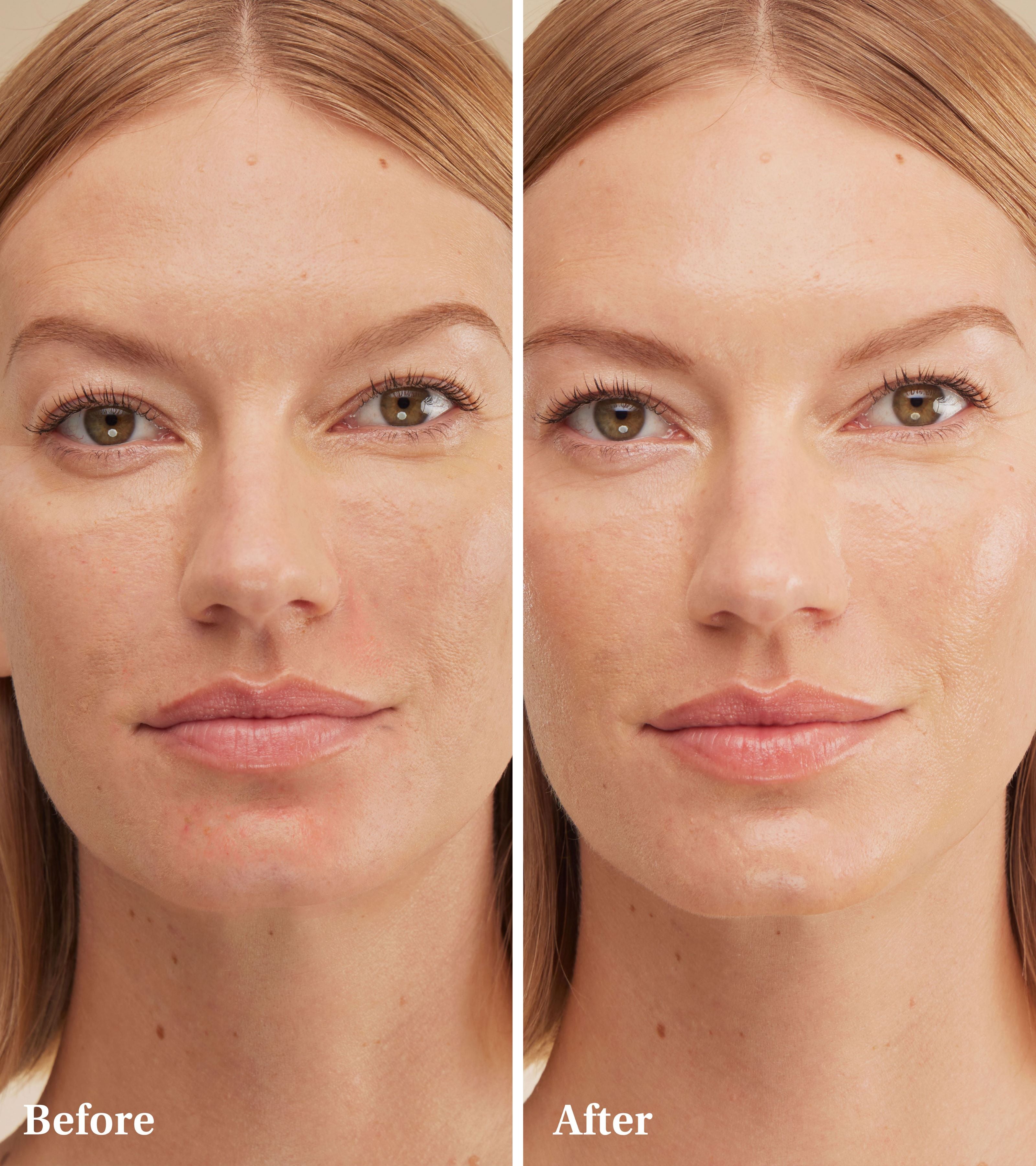 Spaoxy Gel (3 Masks)