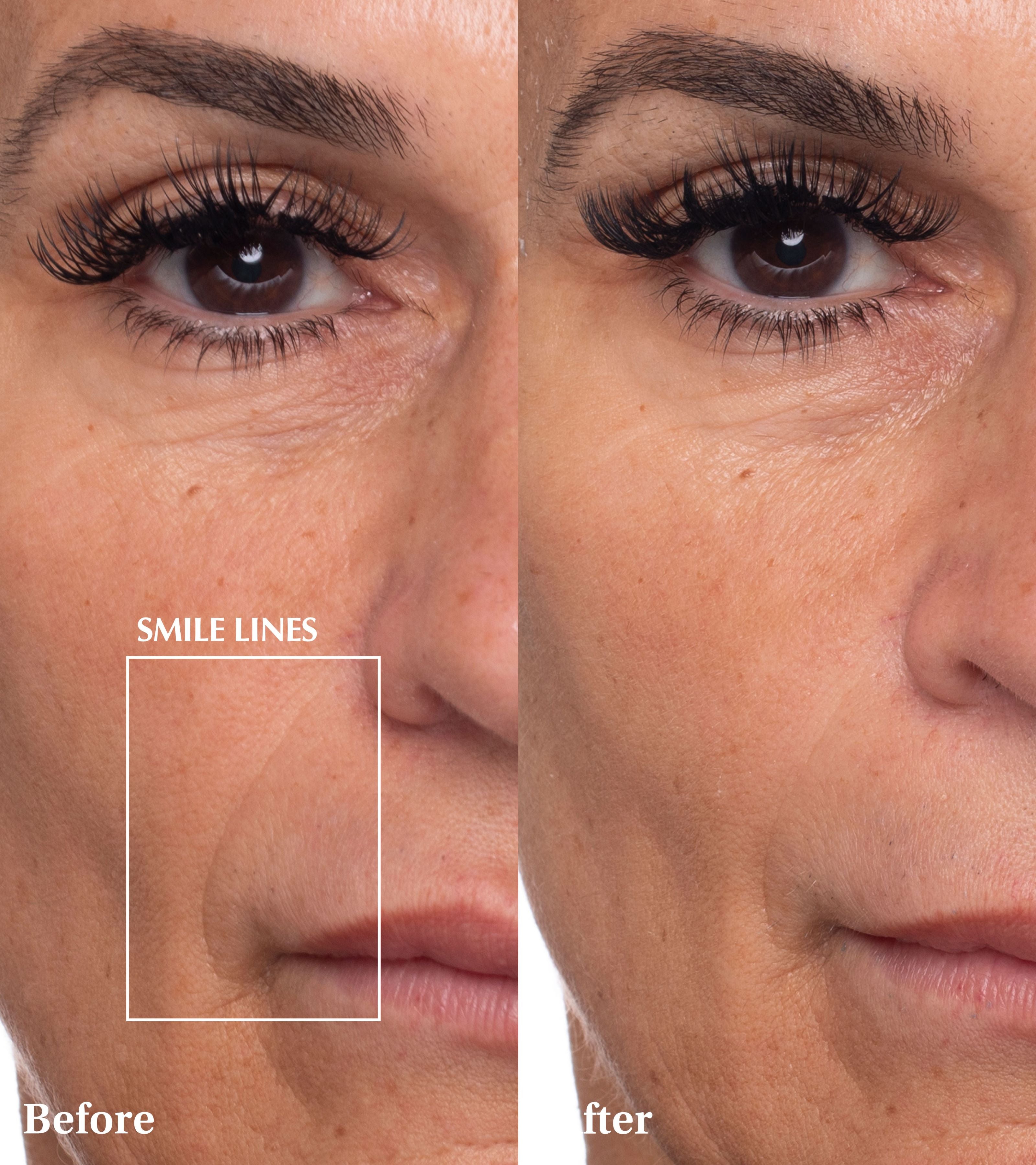 Spaoxy Gel (3 Masks)