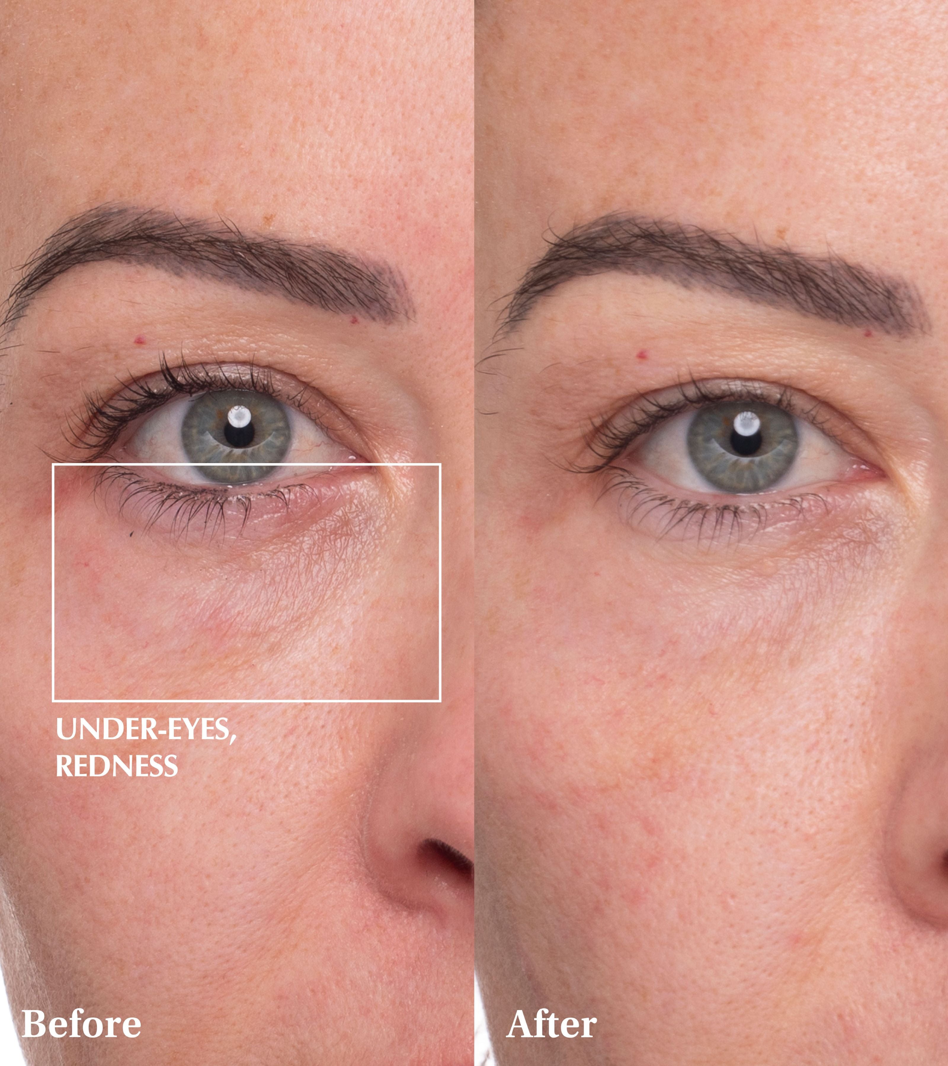 Spaoxy Gel (3 Masks)