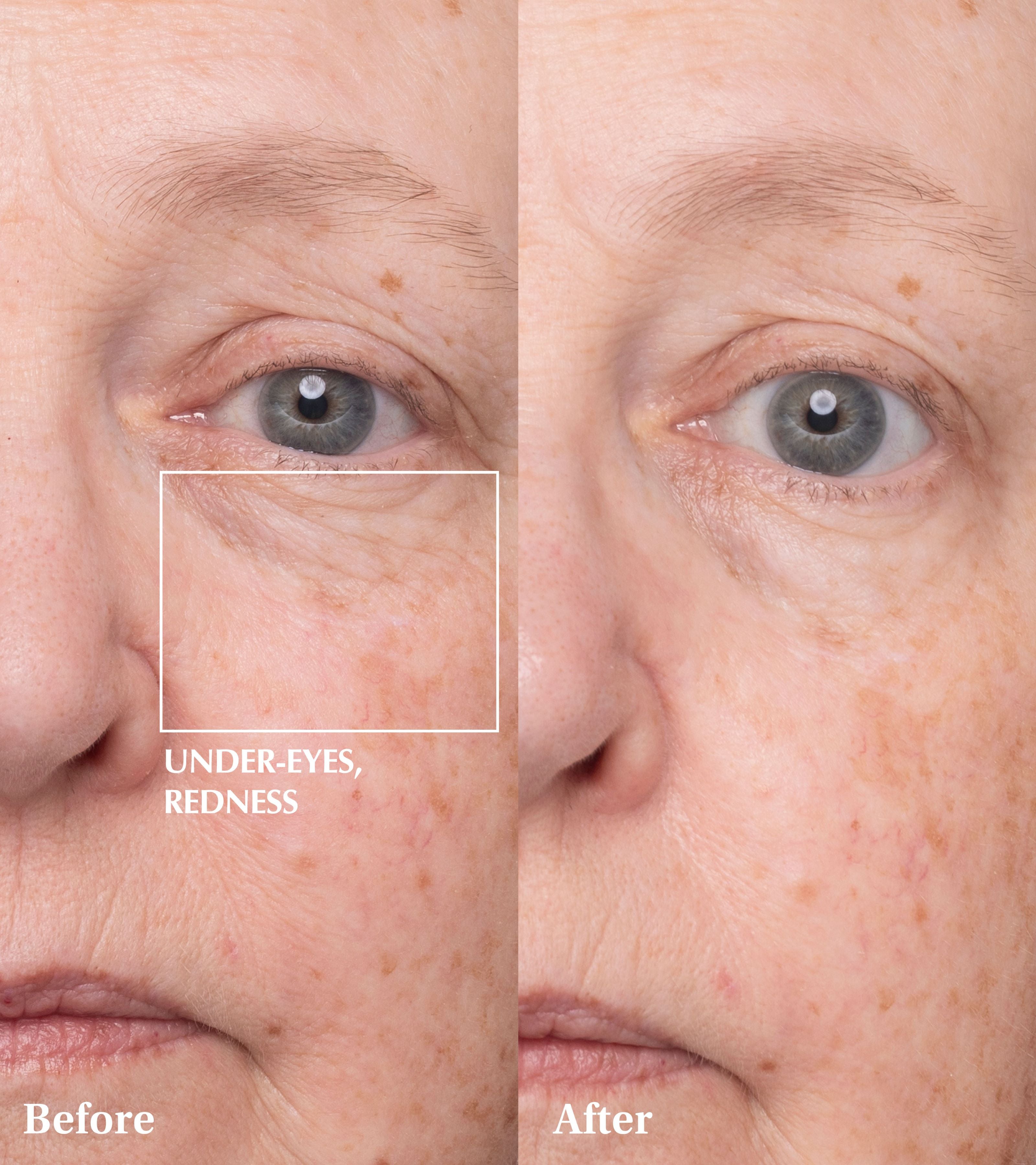 Spaoxy Gel (3 Masks)