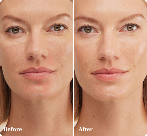 Instant Glow Kit